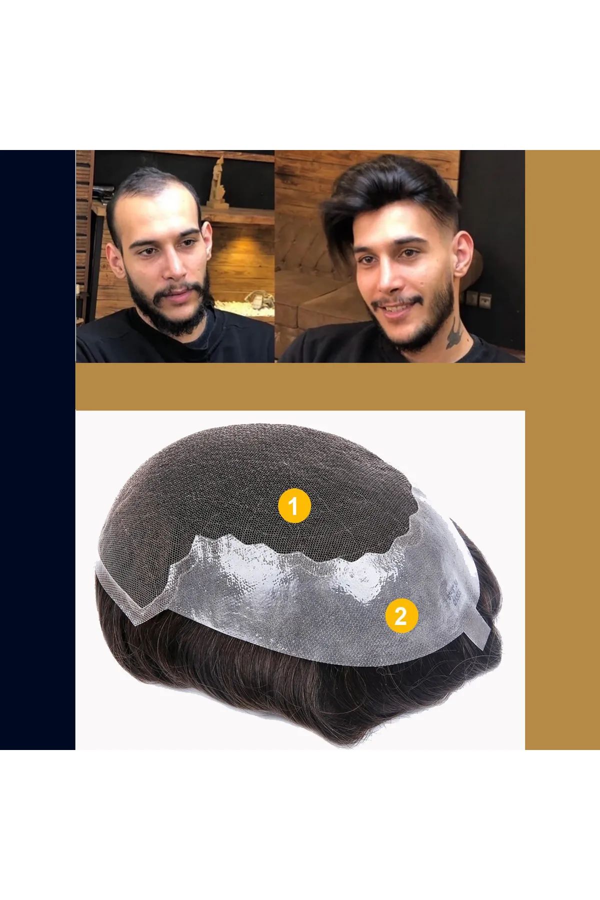 Protez Saç Q6 (Beğenme Garantili)