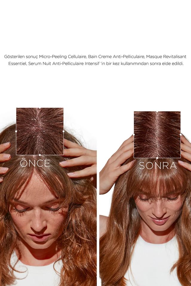 Kerastase Symbiose Bain Creme Anti-Pelliculaire Kepek Karşıtı Nemlendirici Şampuan 250Ml