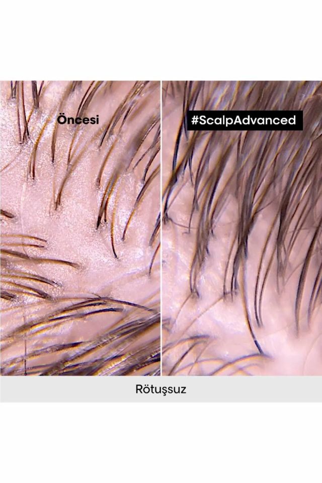Loreal Professionnel Paris Serie Expert Scalp Advanced Yağlanma Karşıtı Profesyonel Şampuan 500 Ml