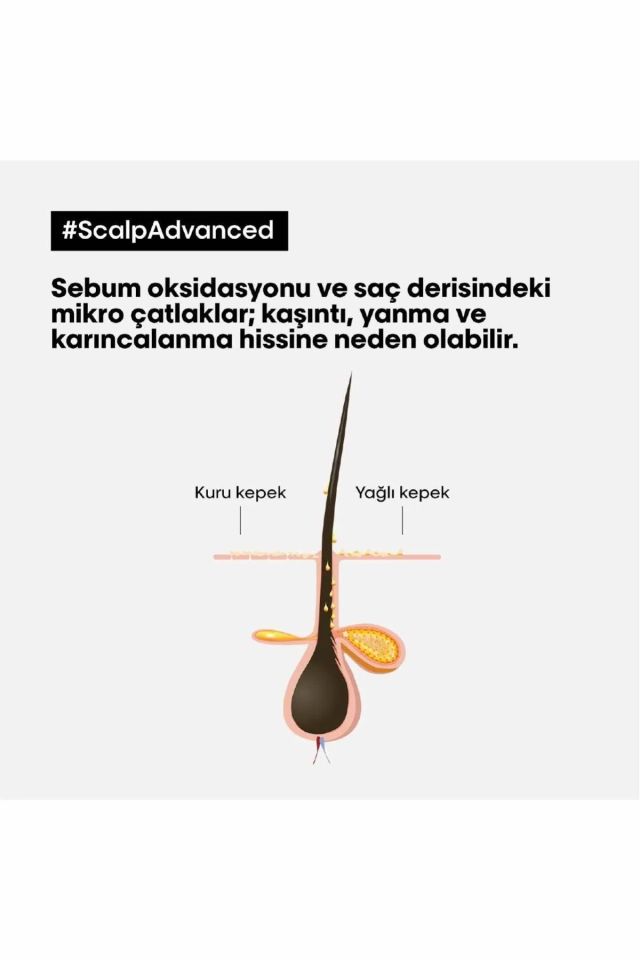 Loreal Professionnel Paris Serie Expert Scalp Advanced Kepek Karşıtı Profesyonel Şampuan 500 Ml