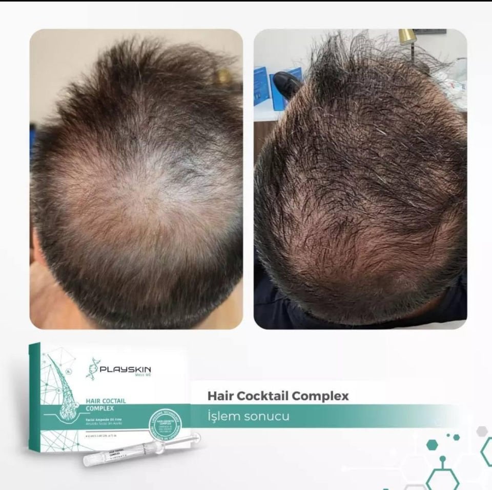 Playskin Liposome Technology Hair Cocktail Complex  Mezoterapi 8 li