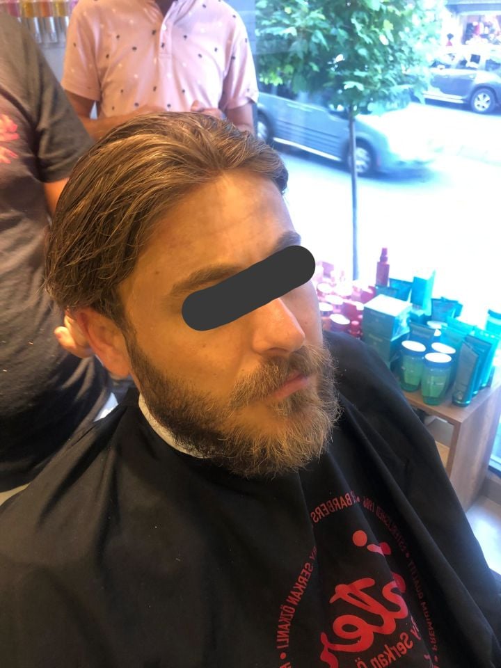 İnter Protez Saç - New Ancora 8x10 1B-Koyu Kestane İnce Telli Her Yöne Taranabilen Alt Yapıda %100 İnsan Saçı