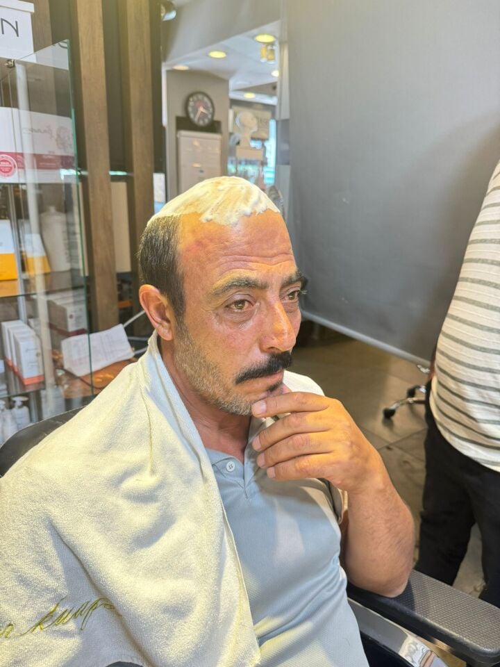 İnter Protez Saç - Avustralya 6x9 1B-Koyu Kestane İnce Telli Her Yöne Taranabilen Alt Yapıda %100 İnsan Saçı