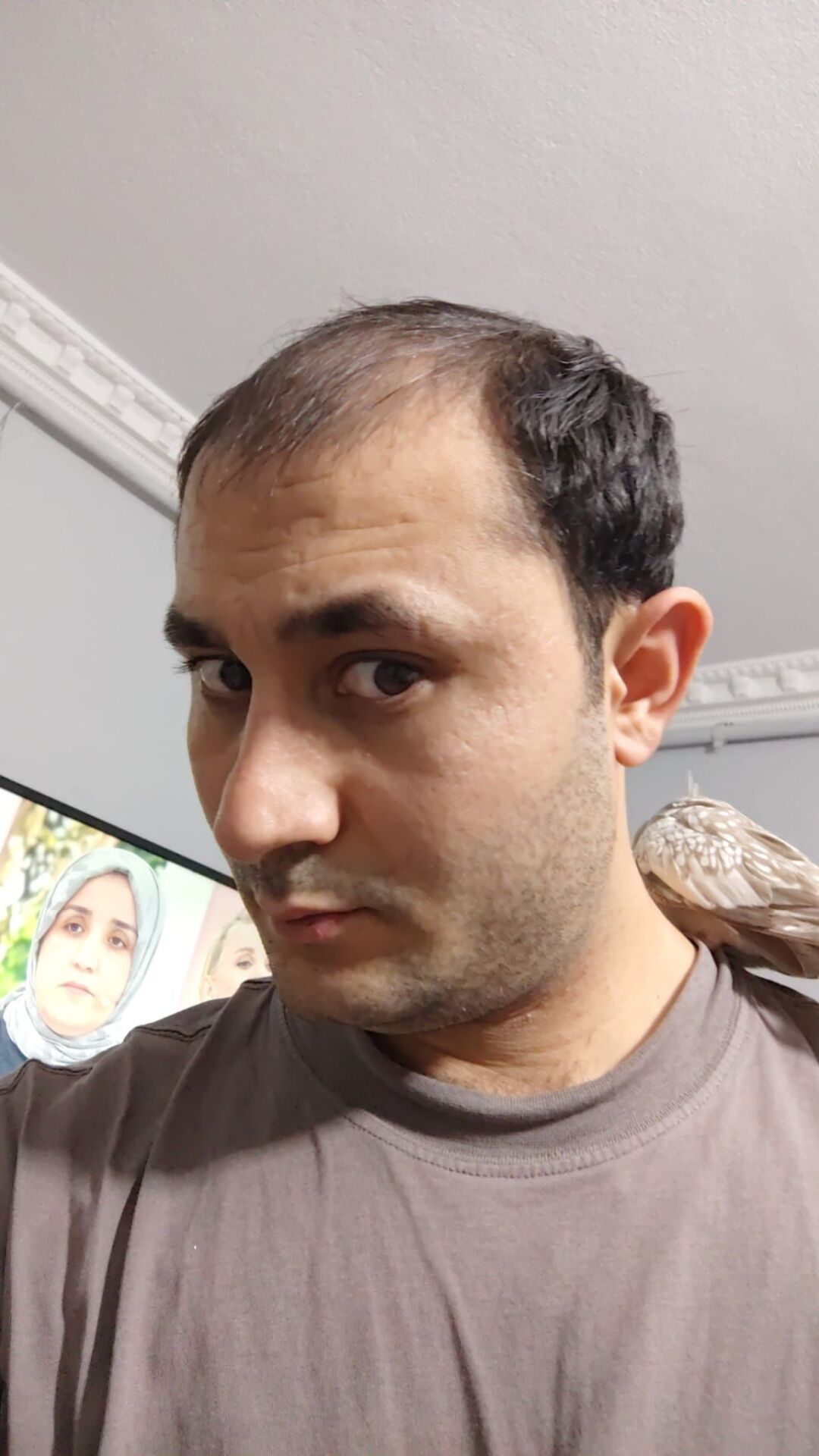 İnter Protez Saç - Avustralya QA8 6x8 1B-Koyu Kestane İnce Telli Her Yöne Taranabilen Alt Yapıda %100 İnsan Saçı