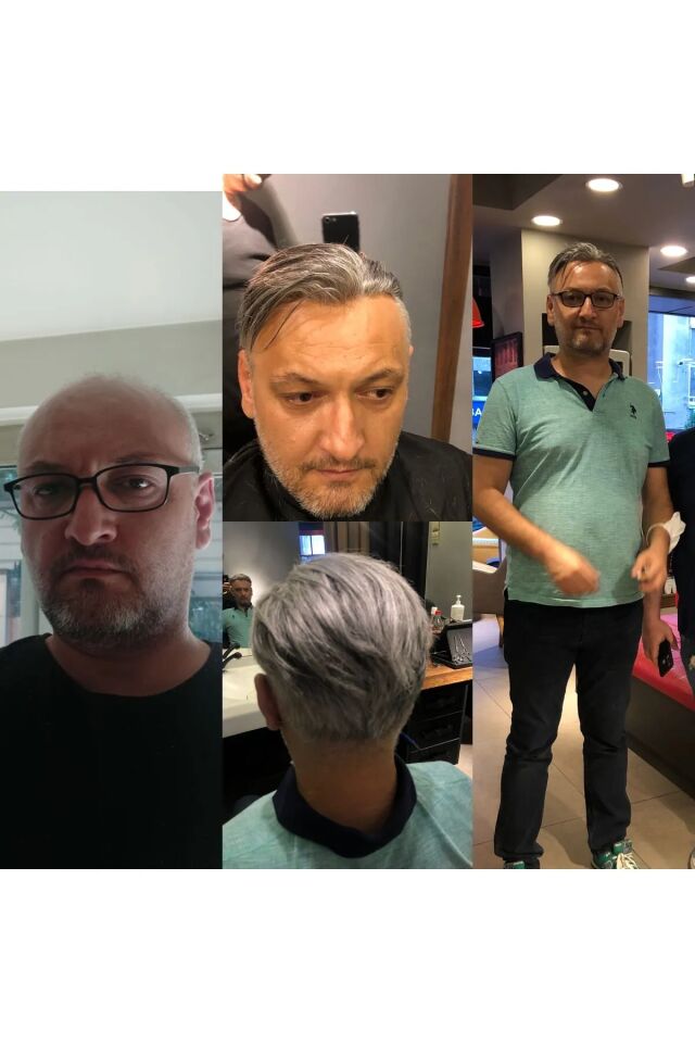 İnter Protez Saç - Avustralya Ancore Mode 6x9 1B-Koyu Kestane İnce Telli Her Yöne Taranabilen Alt Yapıda %100 İnsan Saçı