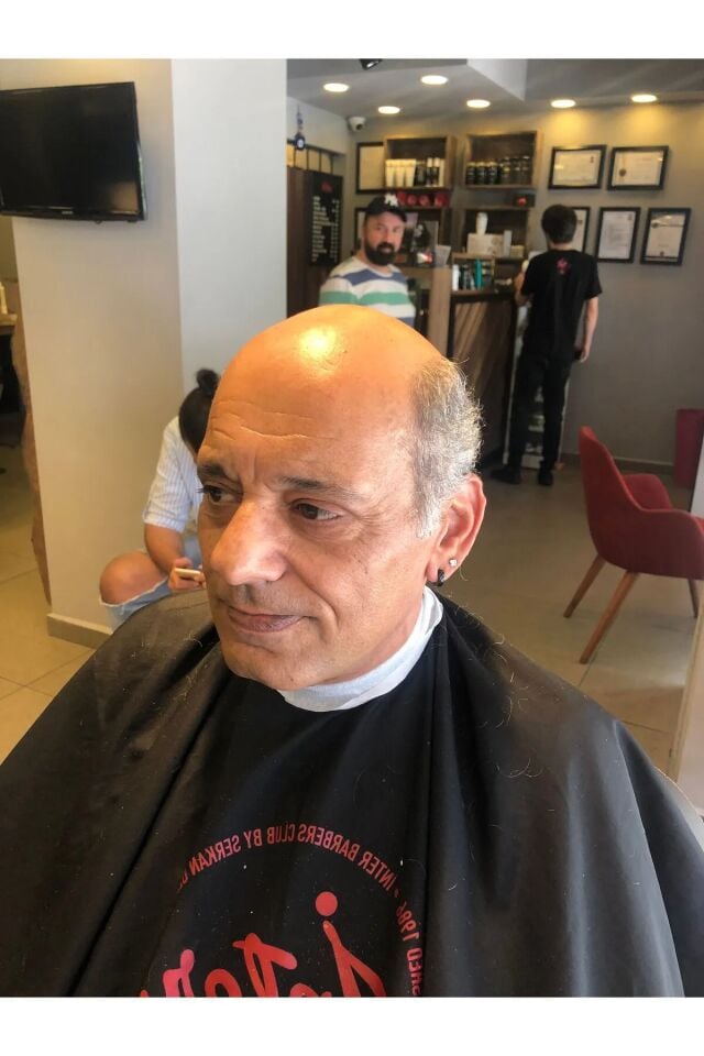 İnter Protez Saç - Avustralya Ancore Mode 7x10 1B-Koyu Kestane İnce Telli Her Yöne Taranabilen Alt Yapıda %100 İnsan Saçı