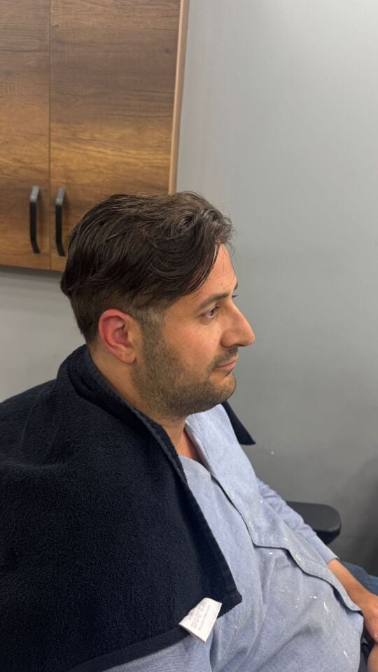 İnter Protez Saç - Avustralya Ancore Mode 6x10 1B-Koyu Kestane İnce Telli Her Yöne Taranabilen Alt Yapıda %100 İnsan Saçı