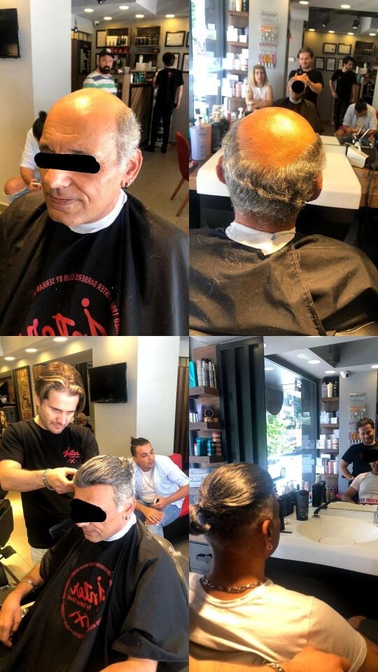 İnter Protez Saç - Avustralya QA8 8x10 1B-Koyu Kestane İnce Telli Her Yöne Taranabilen Alt Yapıda %100 İnsan Saçı