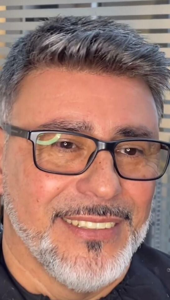Protez Saç New Avusturya - 6x9 - Renk Gri İnce Telli Her Yöne Taranabilen Alt Yapı %100 İnsan Saçı
