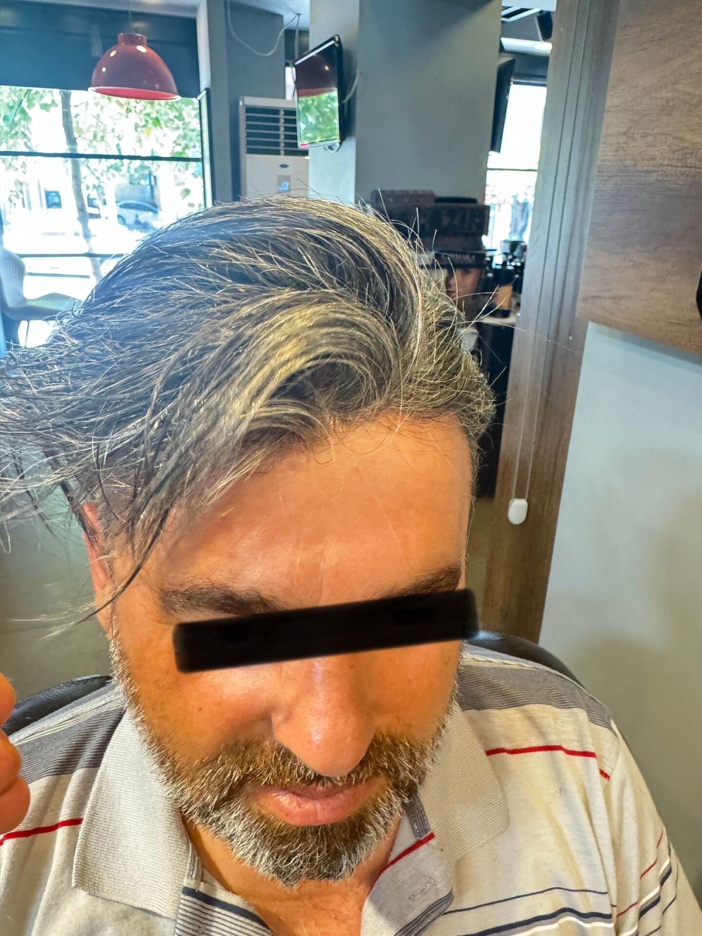 Protez Saç New Avusturya - 6x9 - Renk Gri İnce Telli Her Yöne Taranabilen Alt Yapı %100 İnsan Saçı