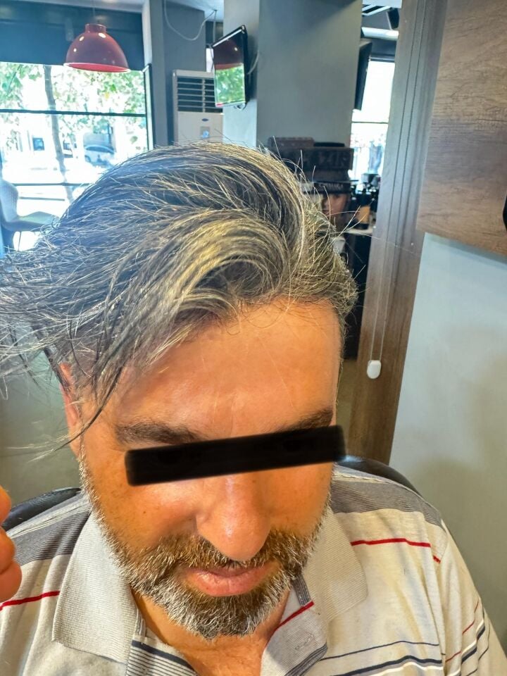 Protez Saç New Avusturya - 6x9 - Renk Gri İnce Telli Her Yöne Taranabilen Alt Yapı %100 İnsan Saçı