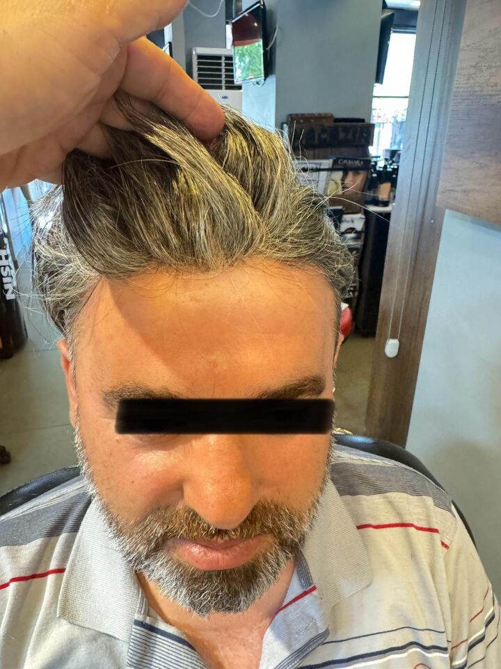 Protez Saç New Avusturya - 6x9 - Renk Gri İnce Telli Her Yöne Taranabilen Alt Yapı %100 İnsan Saçı