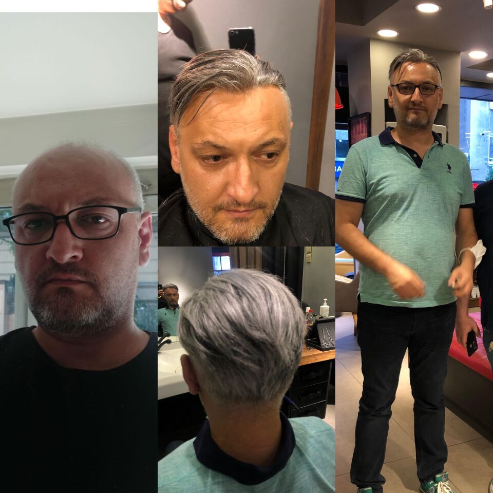 Protez Saç New Avusturya - 6x9 - Renk Gri İnce Telli Her Yöne Taranabilen Alt Yapı %100 İnsan Saçı